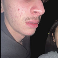 brasko31 - gay de 19 ans